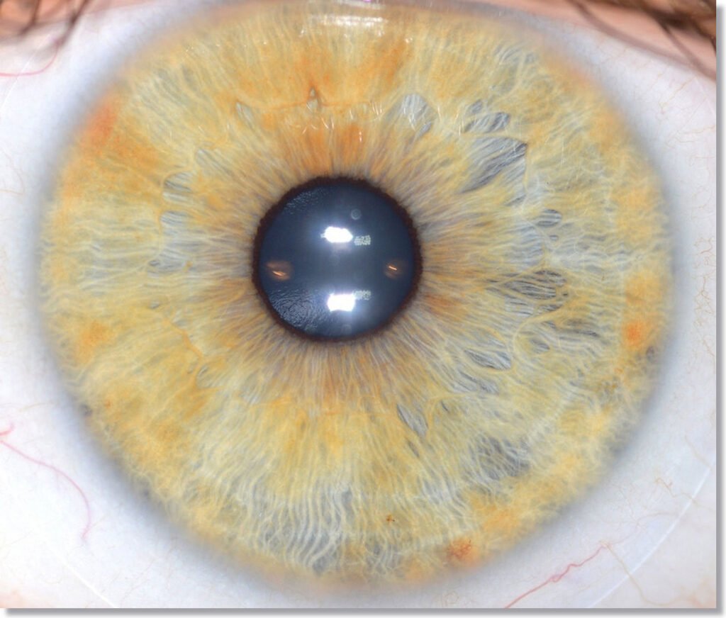 iridology color