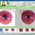 Iriscope Camera Price in India and Iriscope: All You Need to Know