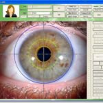 Iriscope Camera Price in India and Iriscope: All You Need to Know