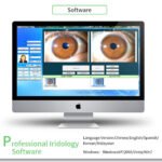 Iriscope Camera Price in India and Iriscope: All You Need to Know