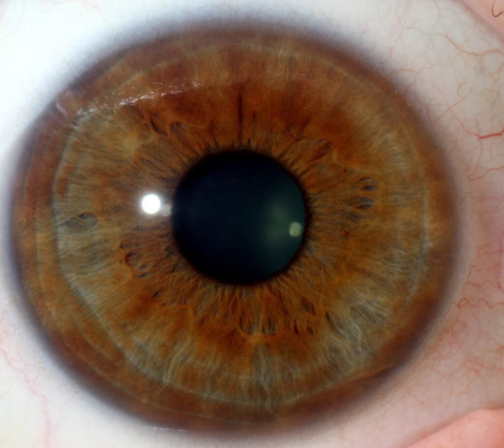 Close-up of Maikong 12MP iridology camera lens capturing an iris