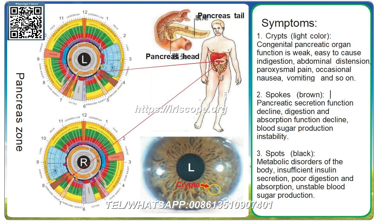 8.1 Iridology – Pancreas Zone