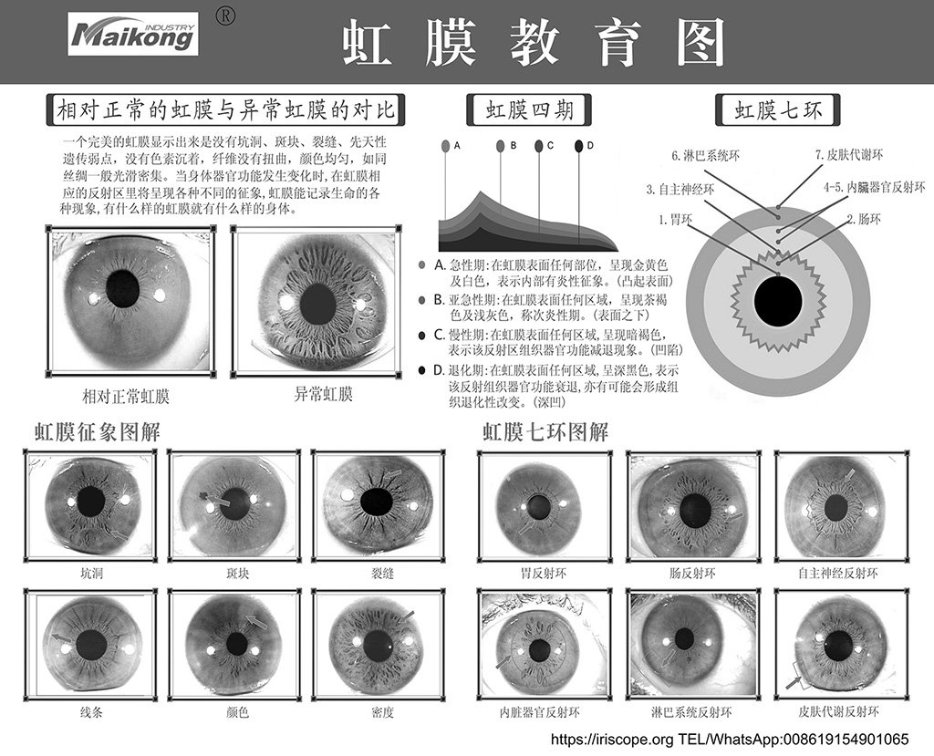 maikong iridology chart 