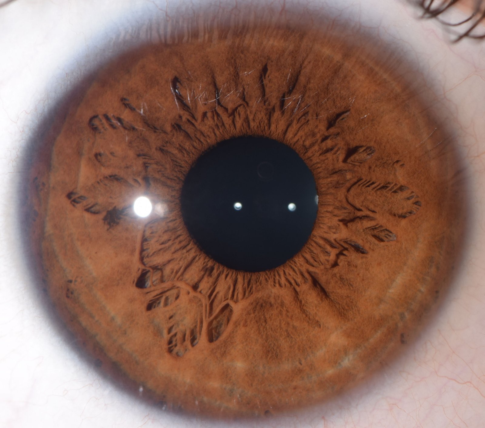 Iridology Camera vs. Microscope: Which Is Better for Iris Study? 25 Iridología