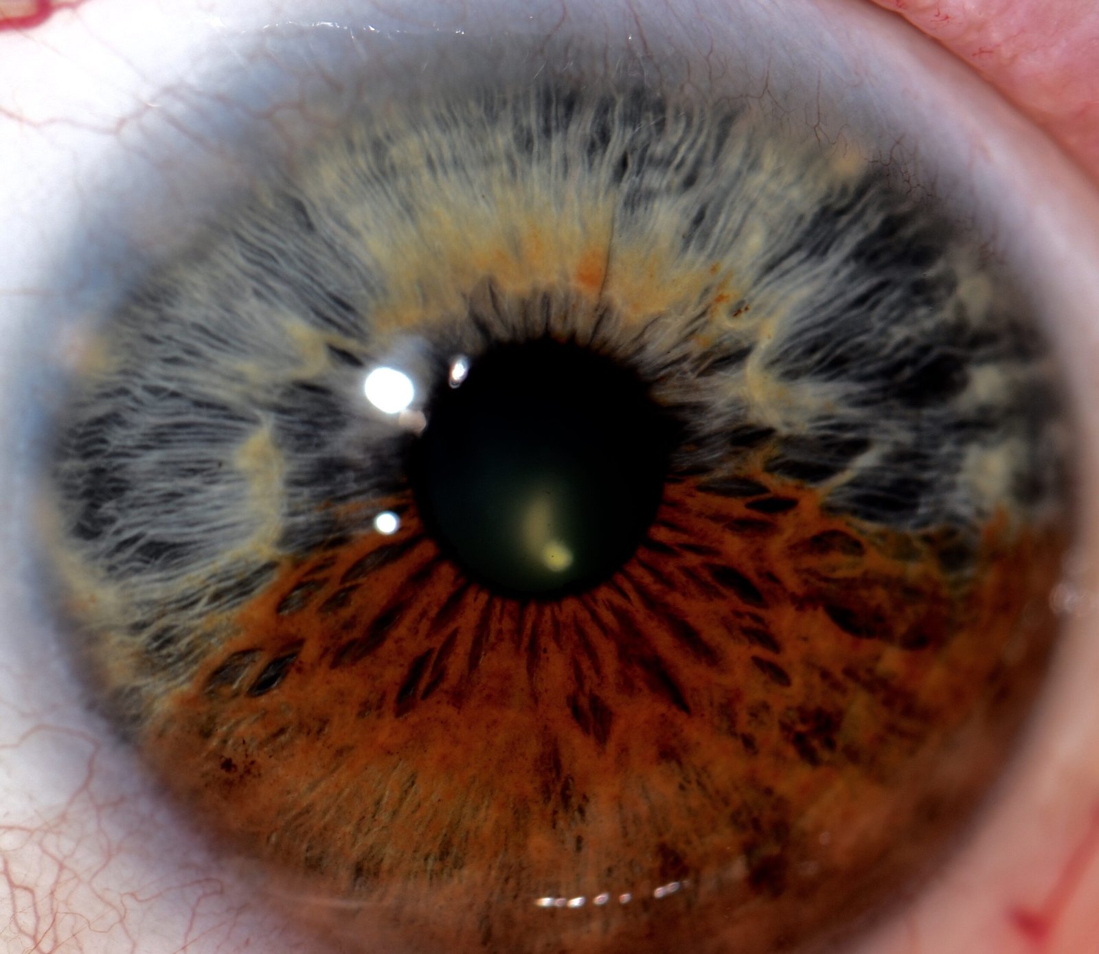 Iridologíaamera vs. Microscope: Which Is Better for Iris Study? 13 Iridología