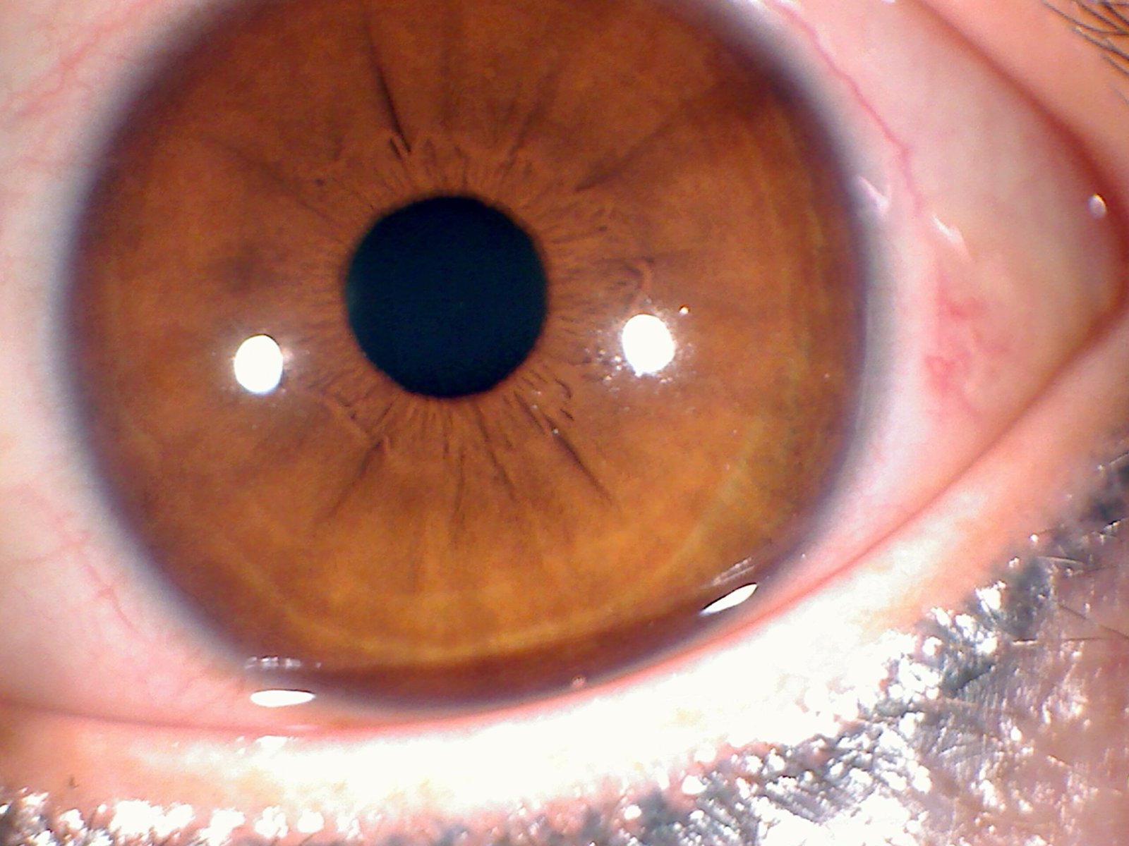 Iridology Camera vs. Microscope: Which Is Better for Iris Study? 12 Iridología