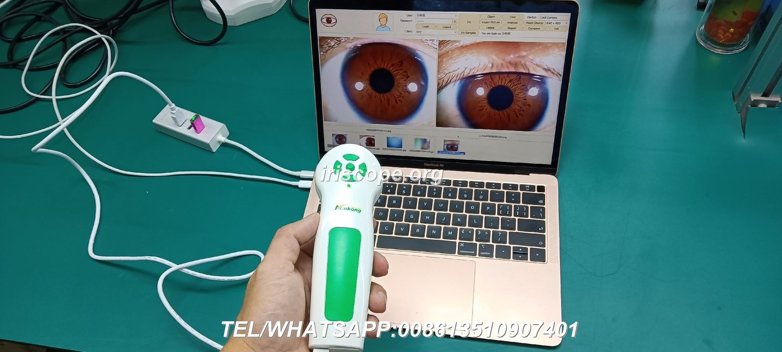 Iridology Camera