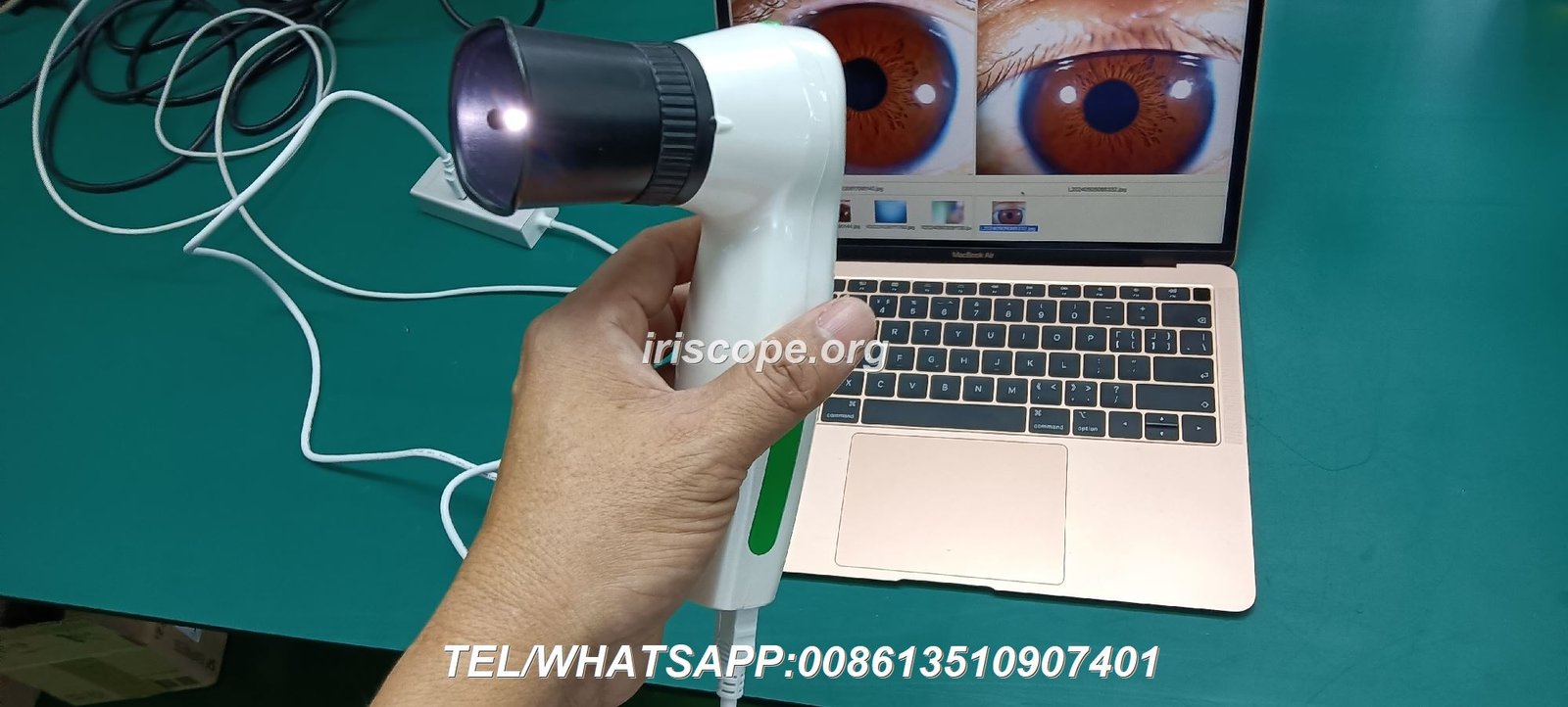 Professional iridology camera capturing detailed iris image