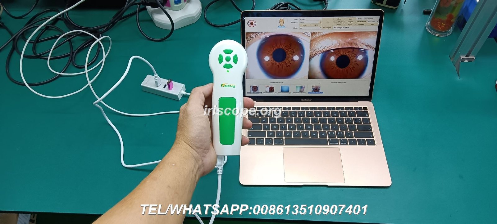 Professional Iridology Camera