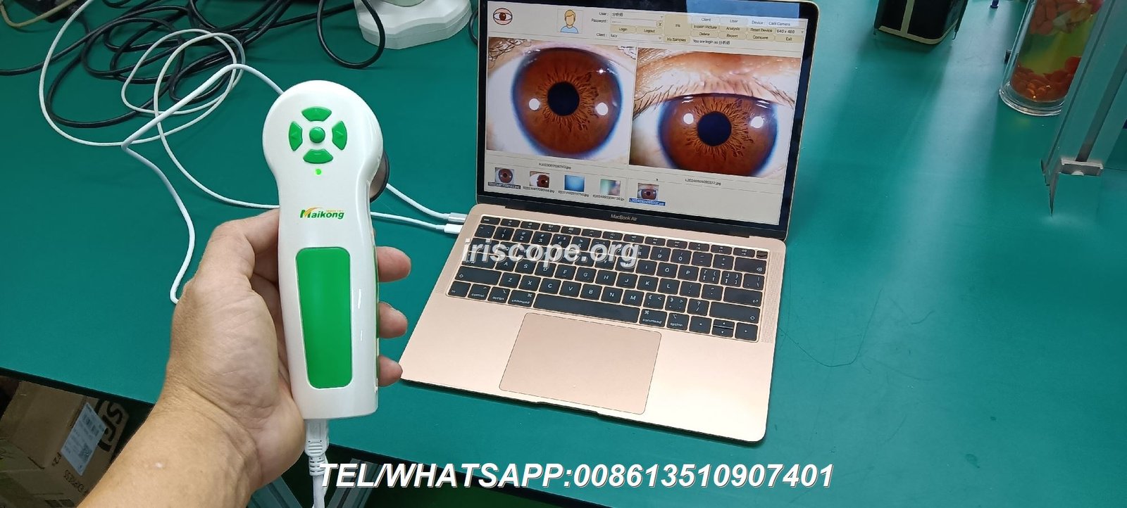 Professional Iridology Camera