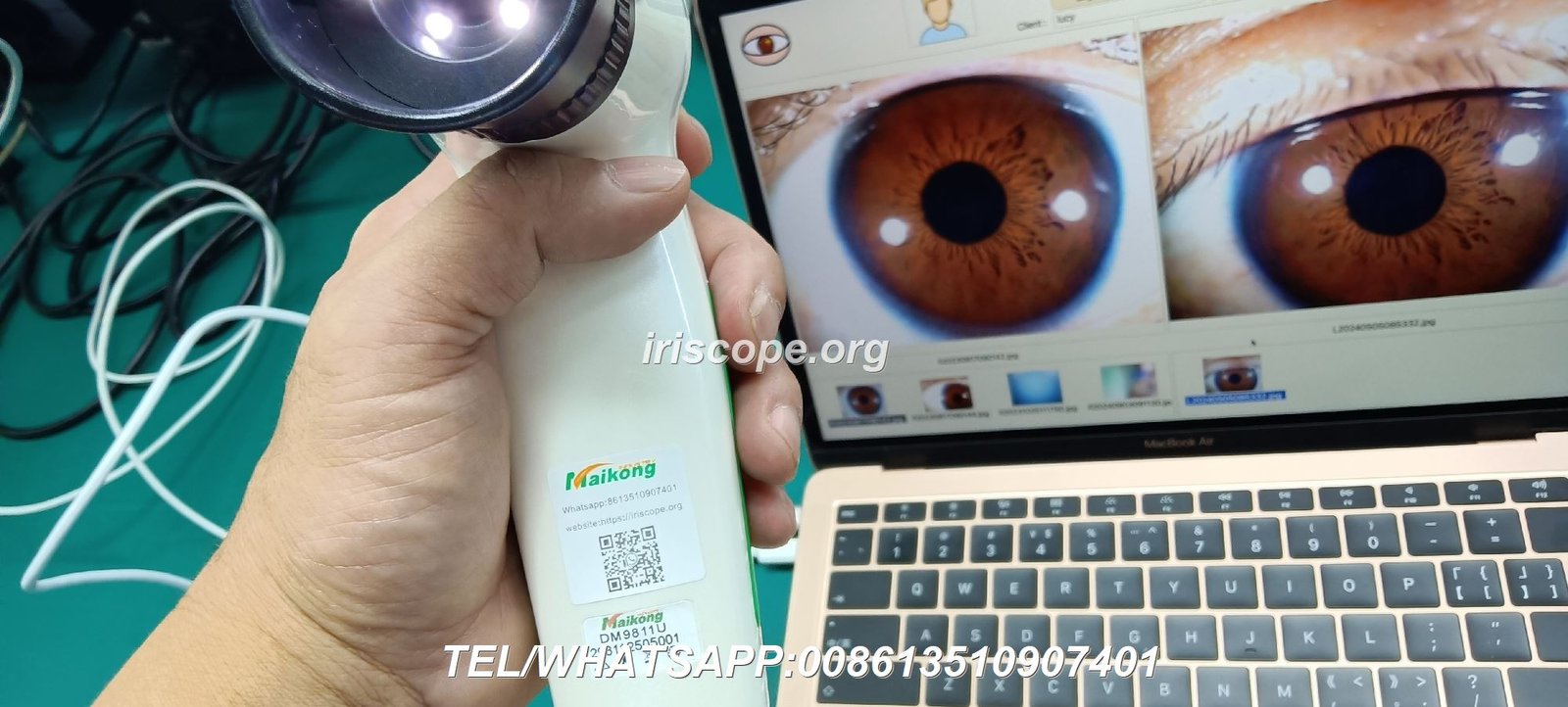  Iridology Camera