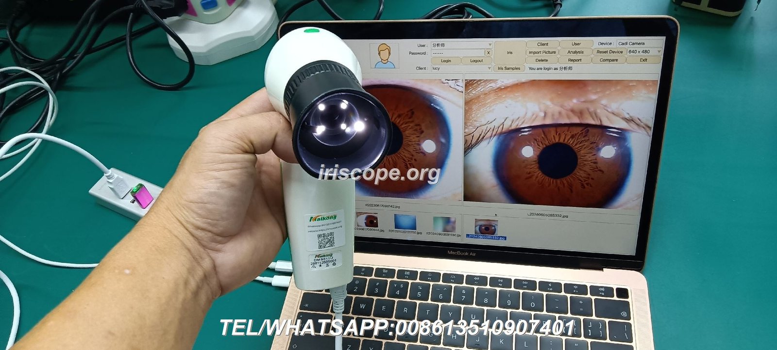 To be maikong FOR MAIKONG iriscope iridology camera Distributor