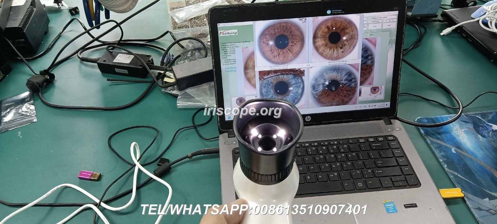 Professional Iridology Camera