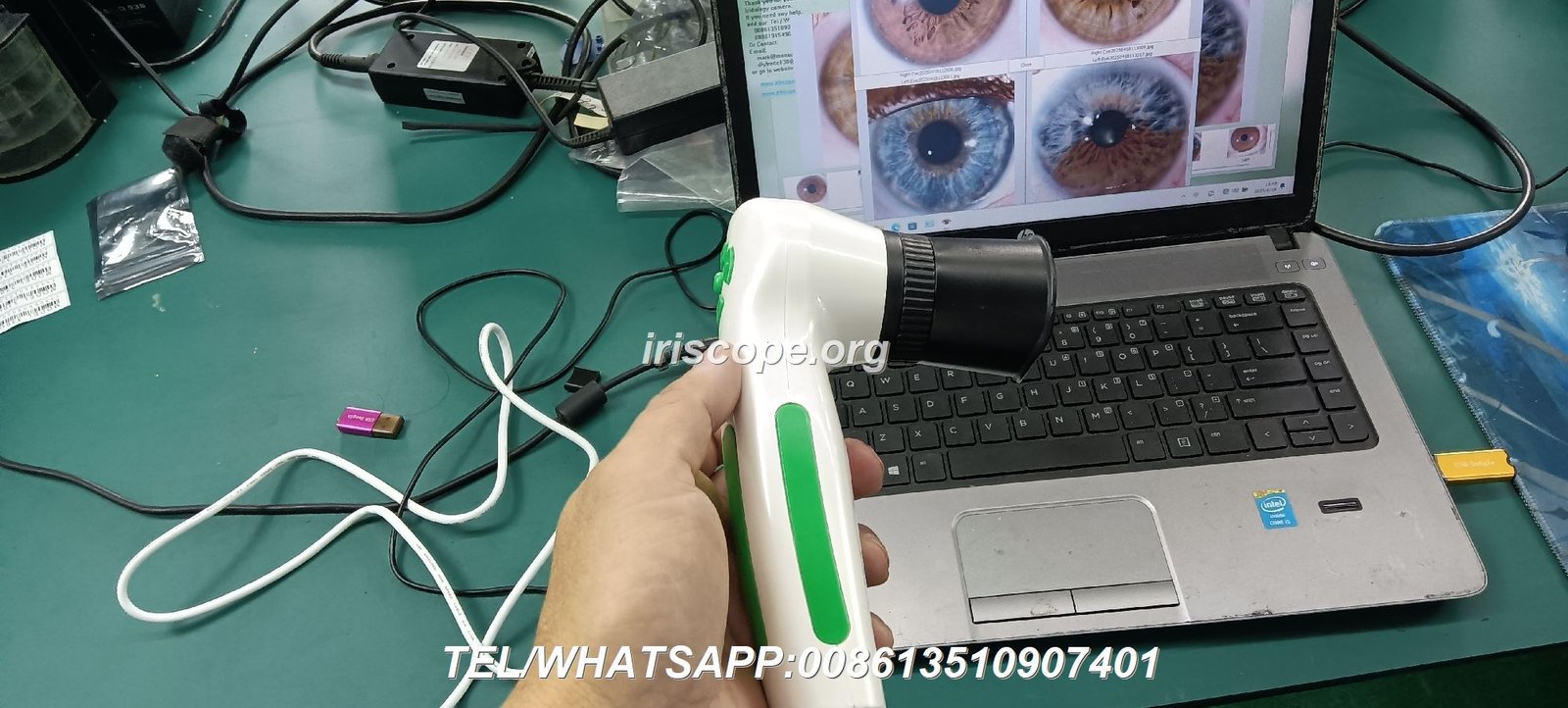 Professional Iridology Camera