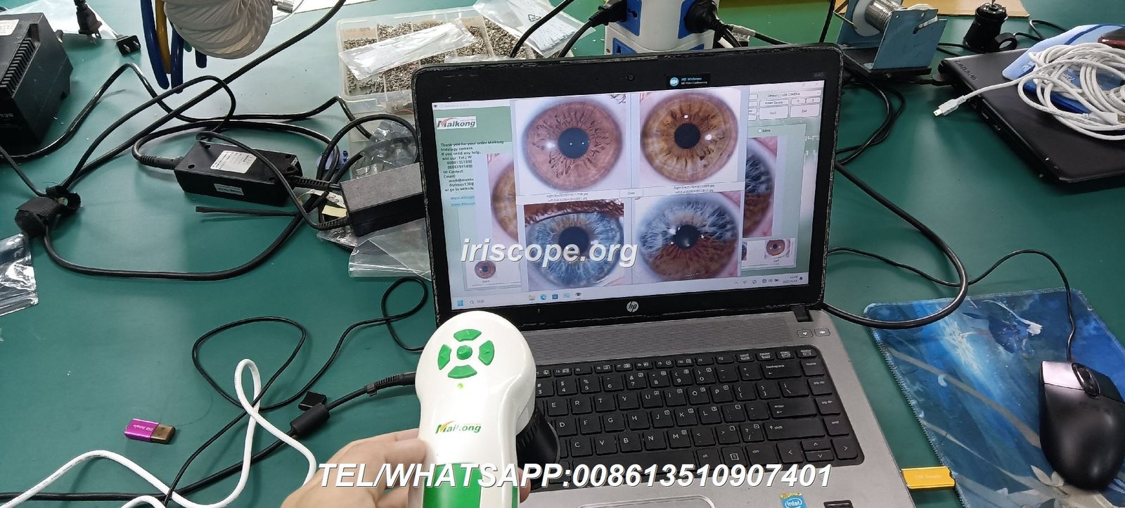Professional Iridology Camera