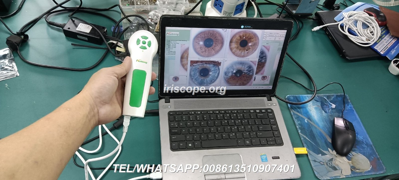 Professional iridology camera capturing detailed iris image
