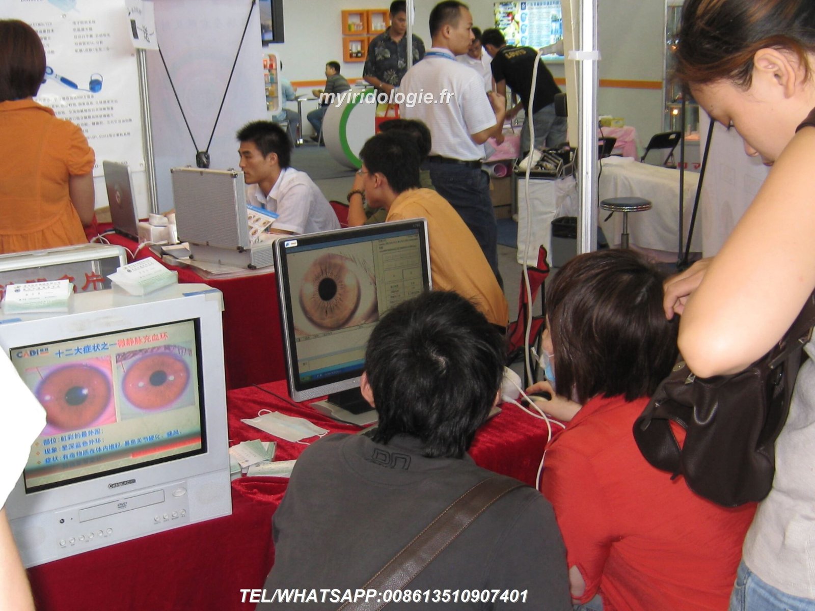 Iridology Iris Diagnosis: Understanding the Practice of Reading Your Eyes