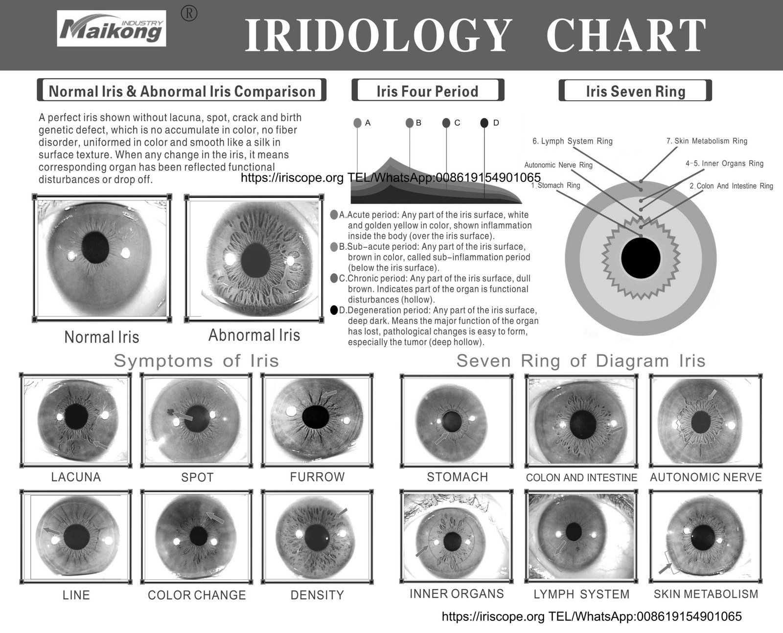 MAIKONG IRIDOLOGY CHART