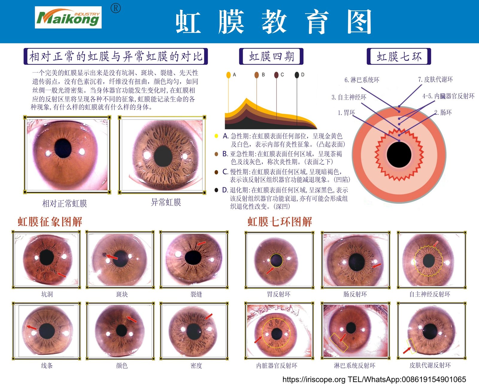 MAIKONG carte iridologie (23)