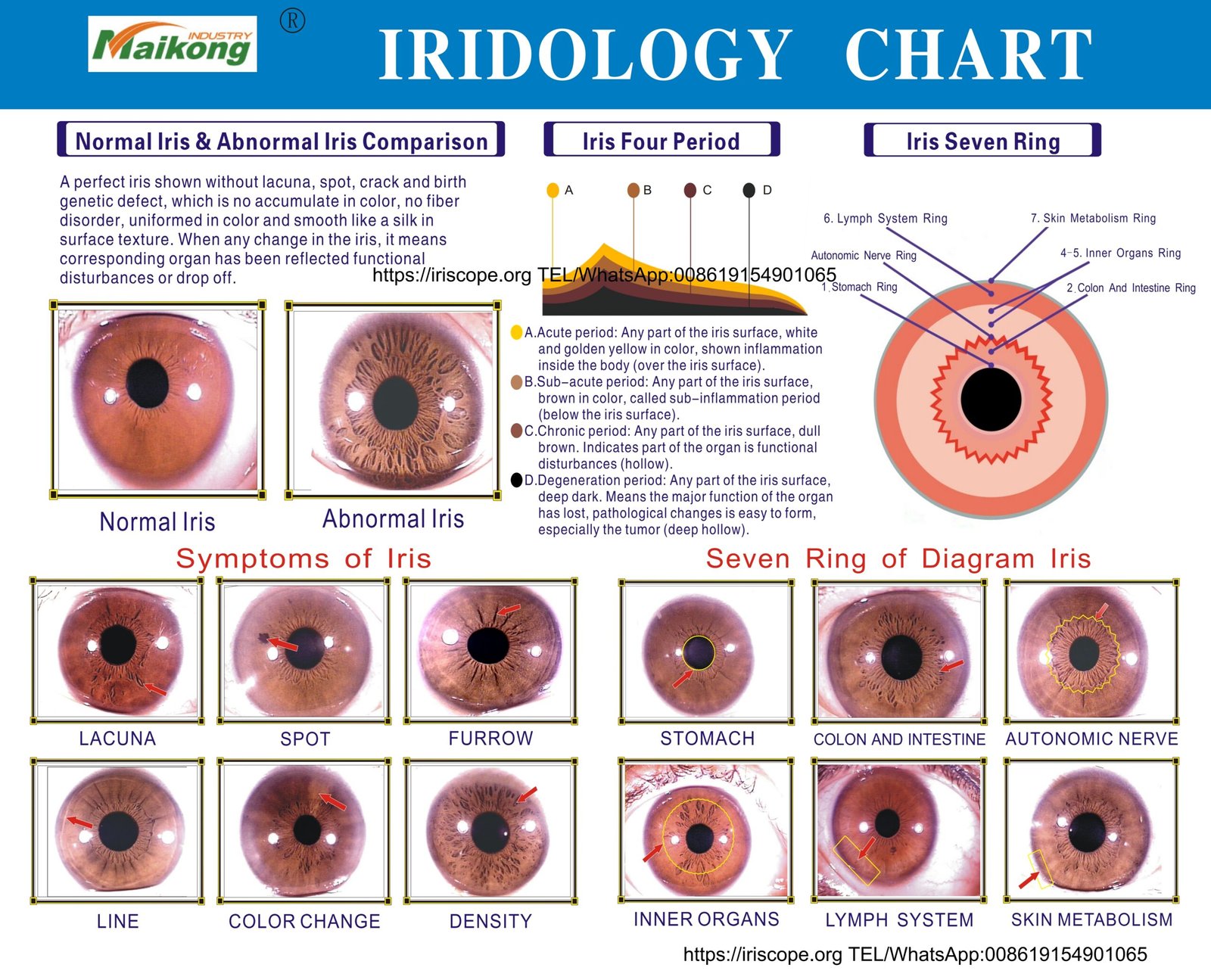 MAIKONG IRIDOLOGY CHART