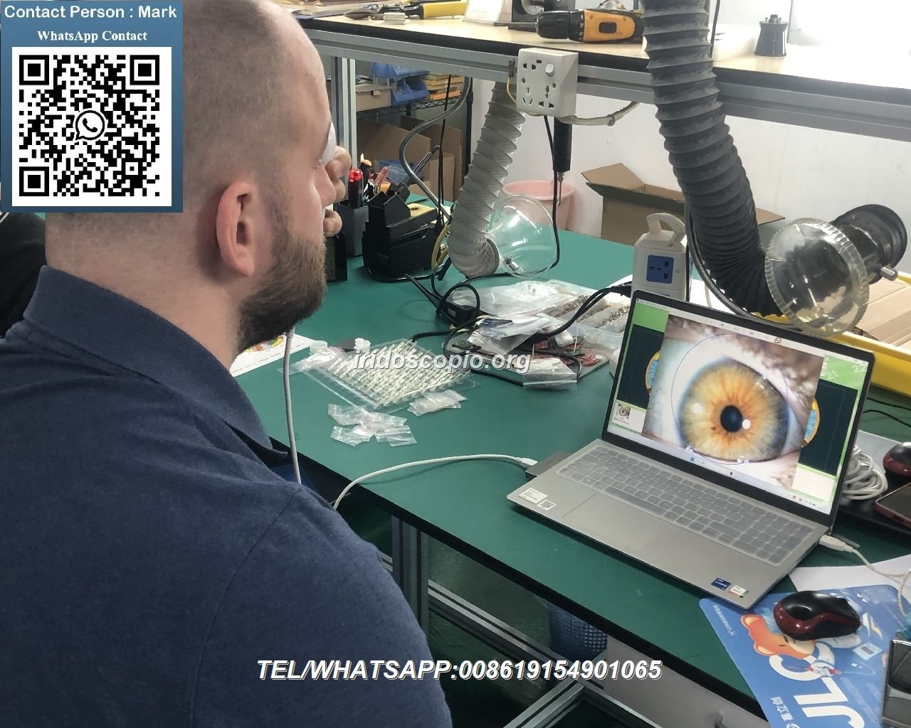 Manual and Automated Iridology Camera Systems