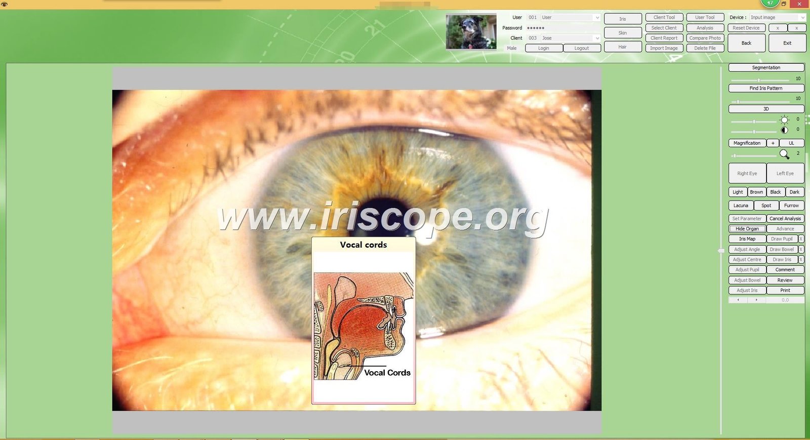 Iridology Camera Software