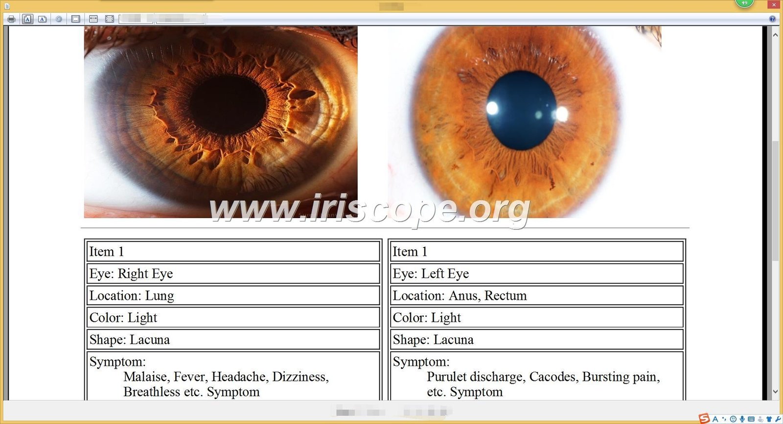 maikong Iridology software