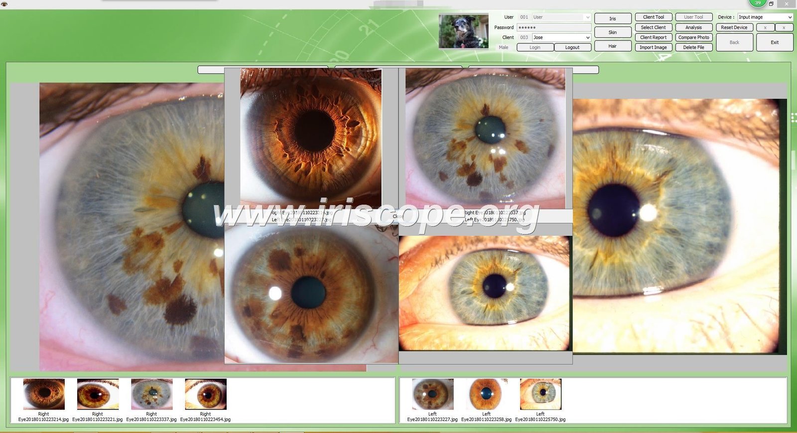 MAIKONG IRIDOLOGY SOFTWARE (58)