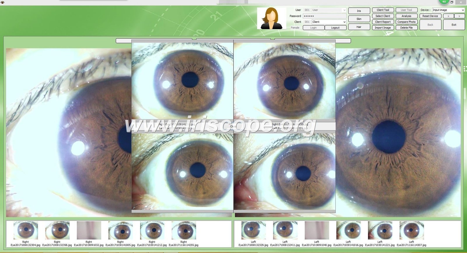 MAIKONG IRIDOLOGY SOFTWARE