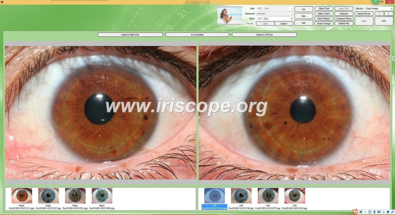 maikong Iridology software