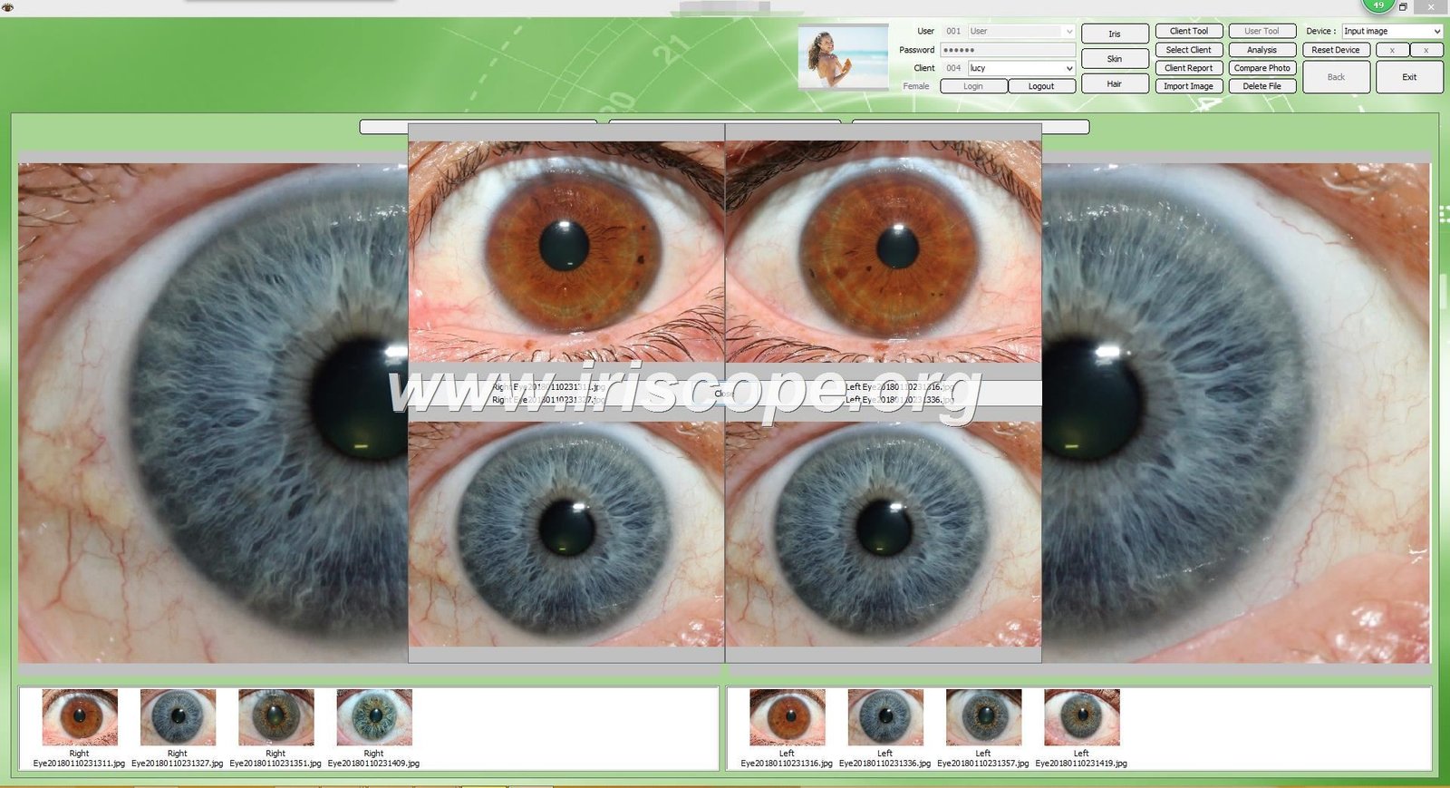 maikong Iridology software