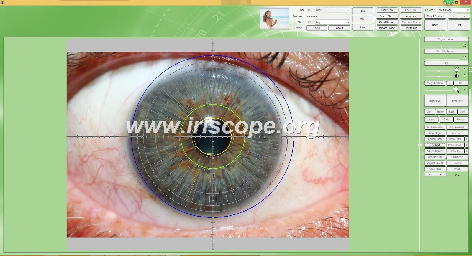 Screenshot of MAIKONG iridology software interface showing multiple language options