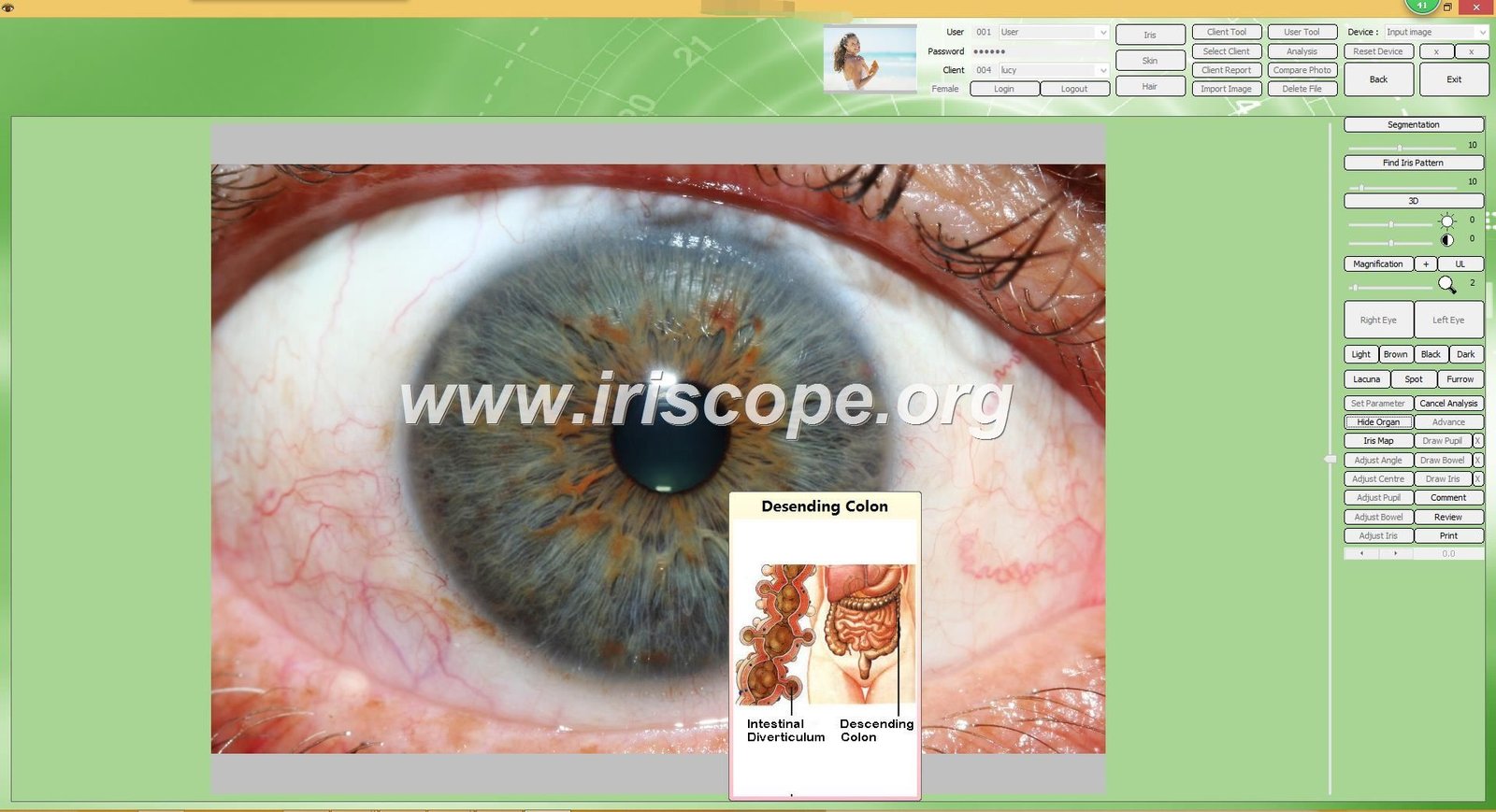 Iridology Camera Software