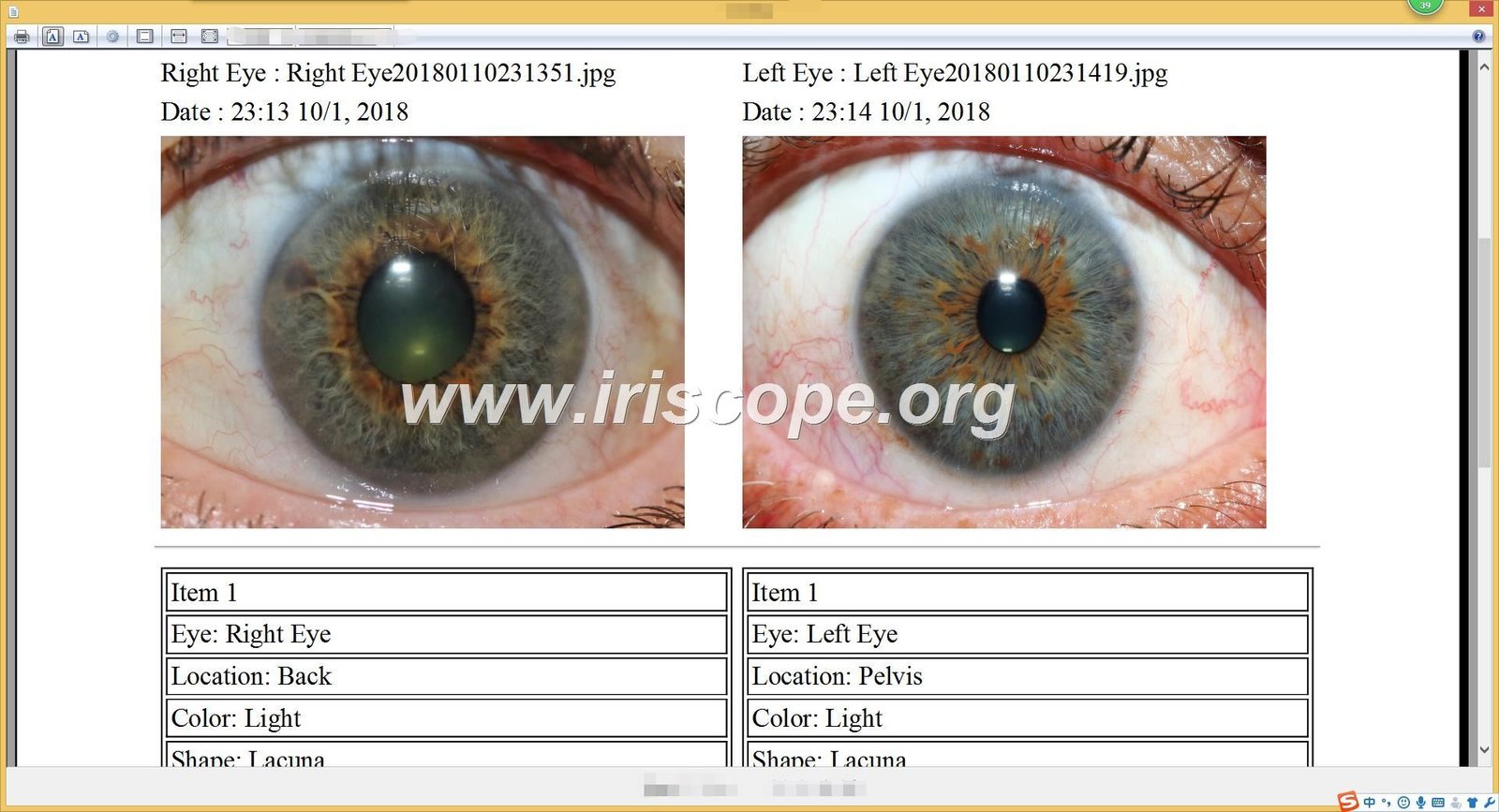maikong Iridology software