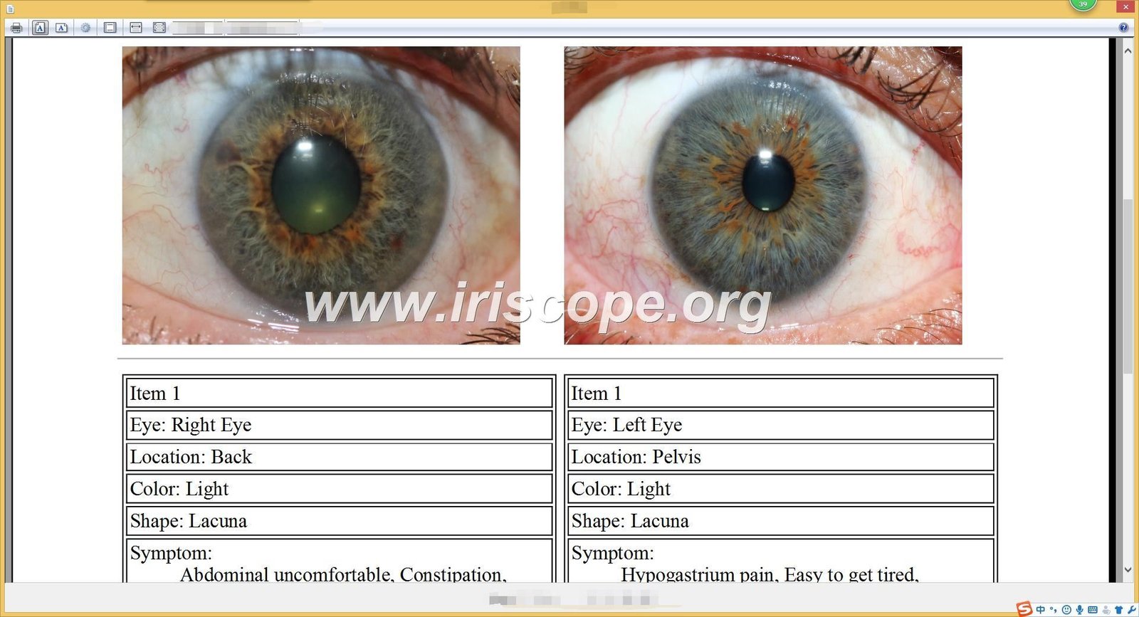 maikong Iridology software Reports