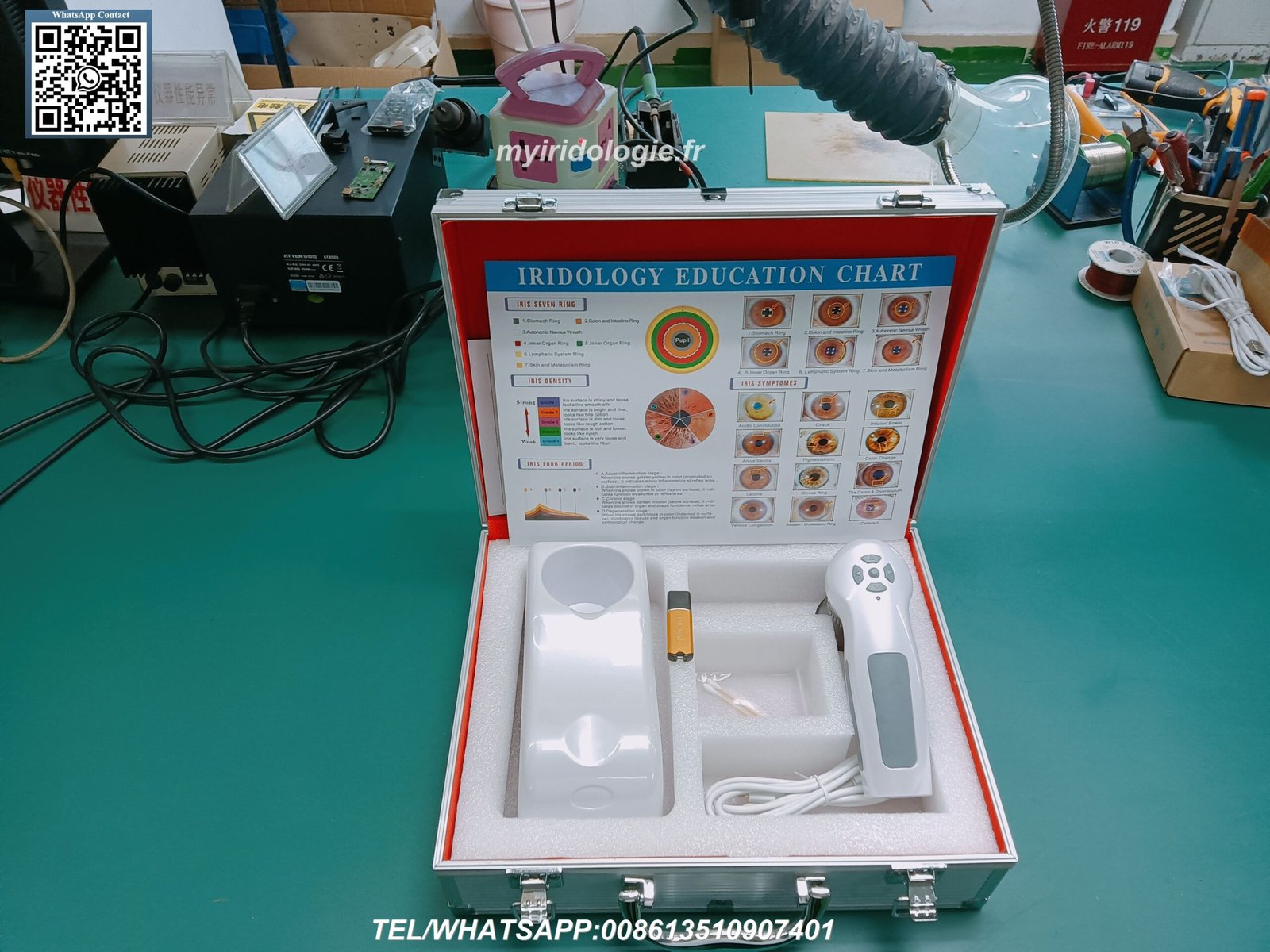 Common iris alignment challenges diagram showing distance, angle, and lighting issues